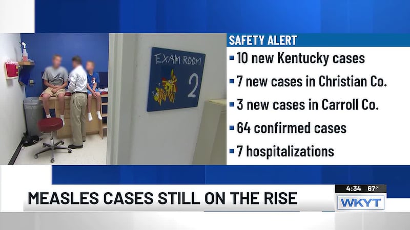 Measles cases see sharp increase in Kentucky